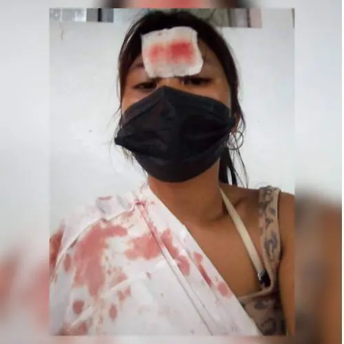 Woman throwed by a stone at Brgy. Lingasad, Polanco ZDN
