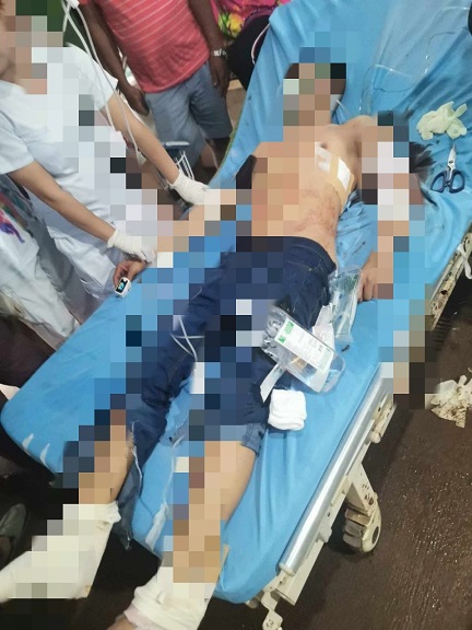 1 miembro de PCG irido na incidente de tiroteo